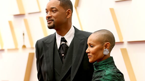The hair loss condition at the center of Will Smith's Oscars slap