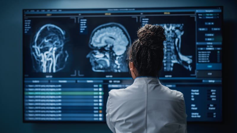 a woman doctor stands in front of a screen showing brain scans