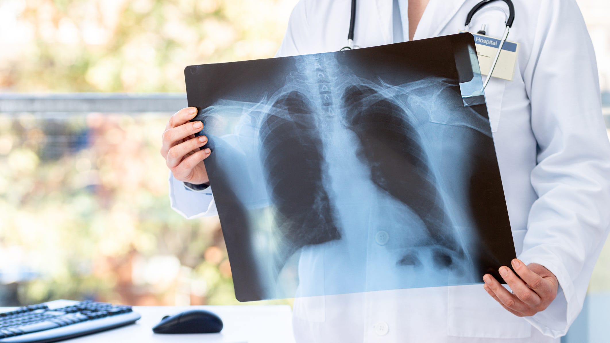 Data shows that one in five patients experience long COVID after infection