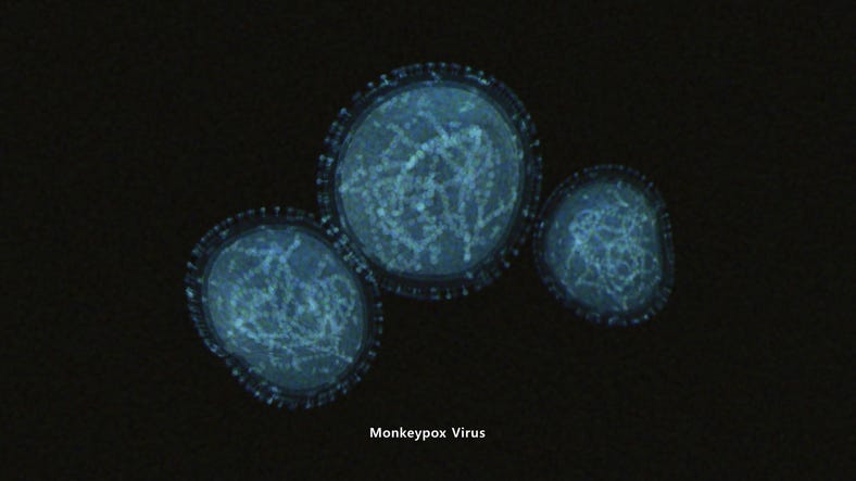 Monkeypox