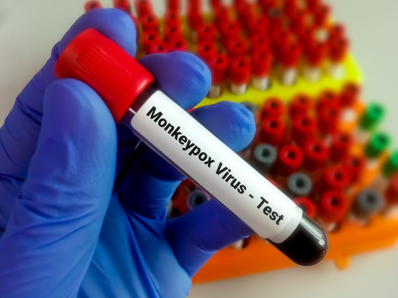 Indiana monkeypox