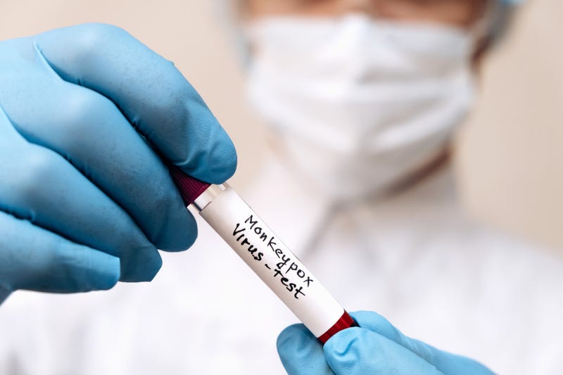 Monkeypox threat level raised in Missouri