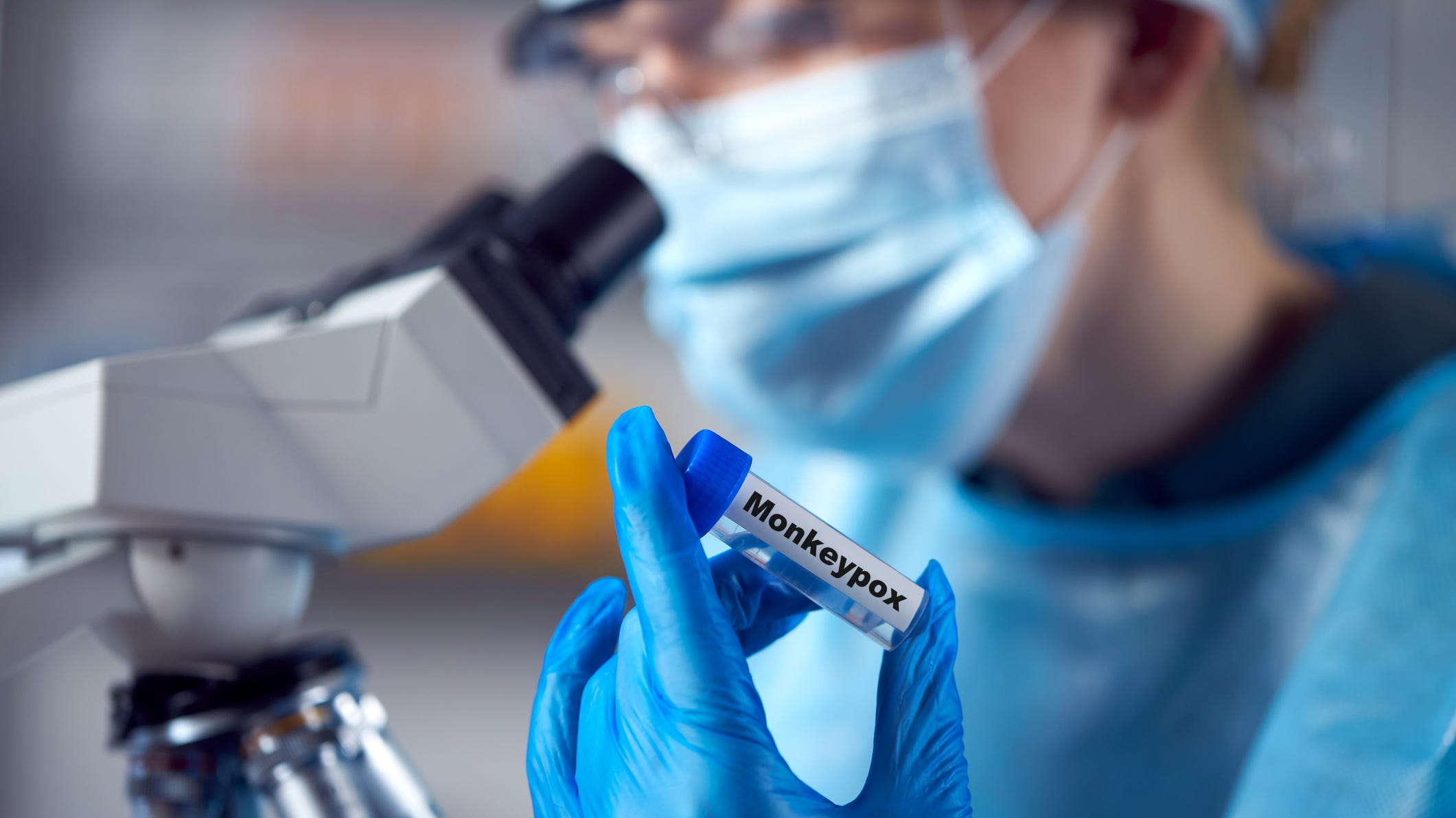 Monkeypox cases rising in Texas