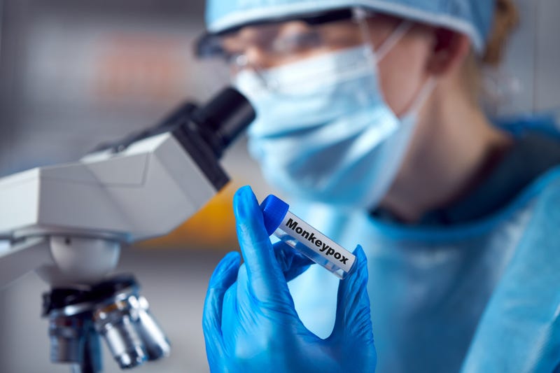 Female Lab Research Worker Wearing PPE Holding Test Tube Labelled Monkeypox