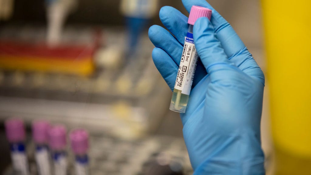 Health experts 'cautiously optimistic' as monkeypox cases wane in SF