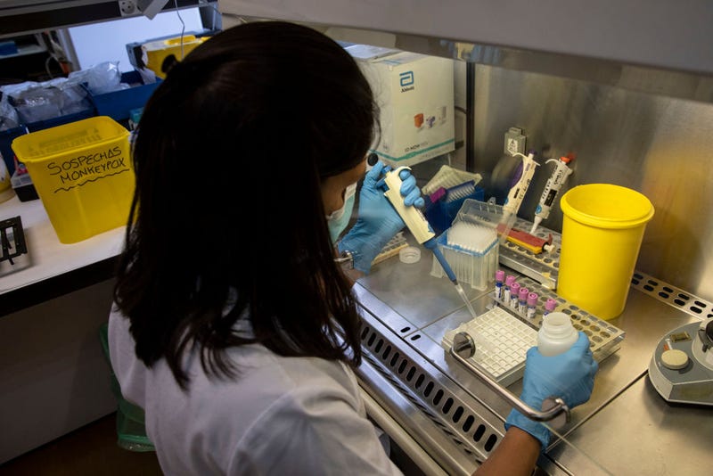  A medical laboratory technician inactivates suspected monkeypox samples to be tested at the microbiology laboratory of La Paz Hospital on June 06, 2022 in Madrid, Spain. Europe is at the centre of the monkeypox virus outbreak, the World Health Organisation reported 780 confirmed cases with Britain, Spain and Portugal reporting the largest numbers of patients. (Photo by Pablo Blazquez Dominguez/Getty Images)