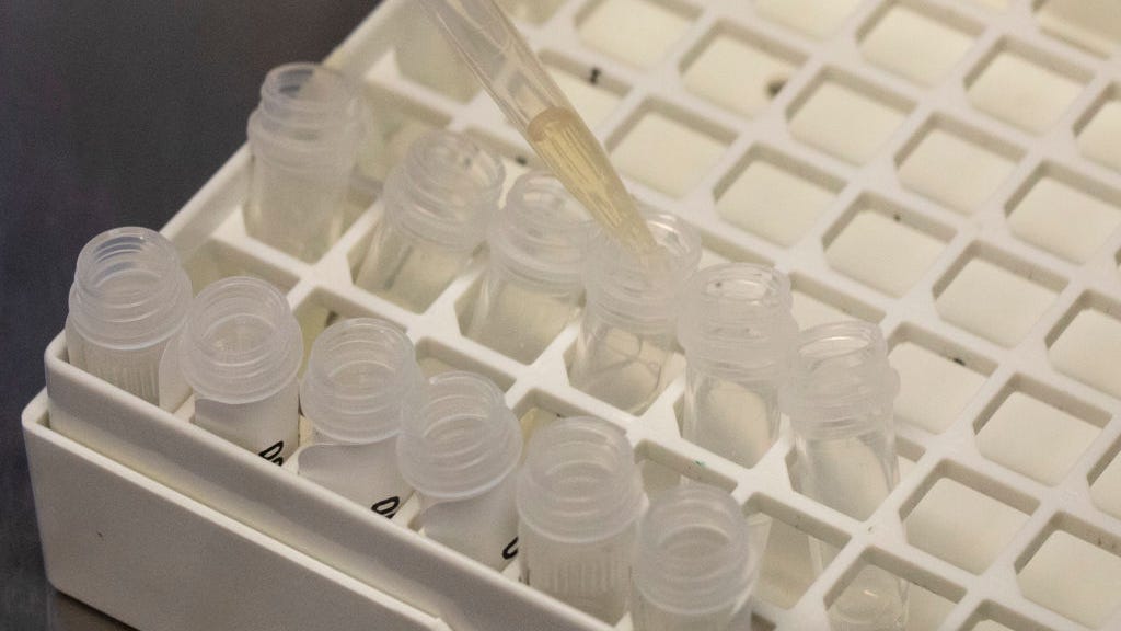This Bay Area county just confirmed its first case of monkeypox