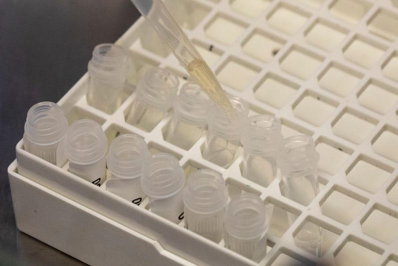 A medical laboratory technician inactivates suspected monkeypox samples to be tested at the microbiology laboratory of La Paz Hospital on June 06, 2022 in Madrid, Spain.