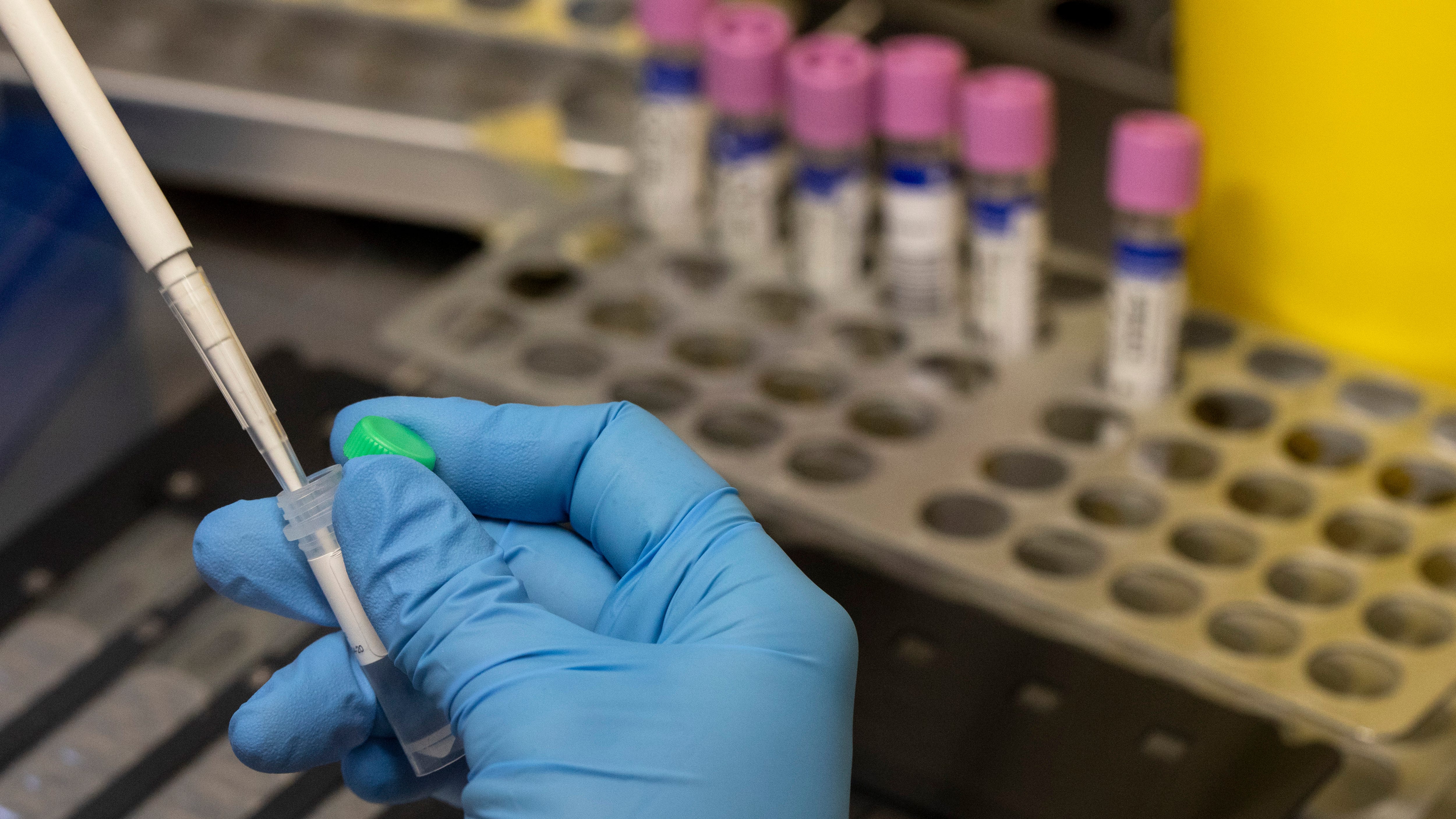 Dallas County Health Department reports first Monkeypox case this year