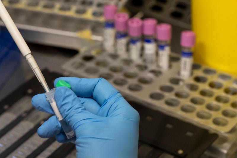 A medical laboratory technician inactivates suspected monkeypox samples to be PCR tested at the microbiology laboratory of La Paz Hospital on June 06, 2022 in Madrid, Spain.