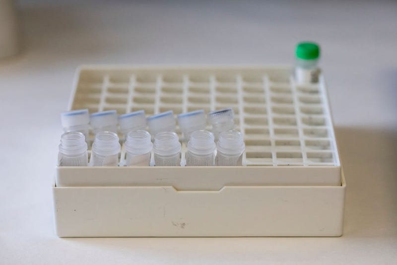 Deactivated suspected monkeypox samples lay on a table before being PCR tested at the microbiology laboratory of La Paz Hospital on June 06, 2022 in Madrid, Spain. Europe is at the centre of the monkeypox virus outbreak, the World Health Organisation reported 780 confirmed cases with Britain, Spain and Portugal reporting the largest numbers of patients. (Photo by Pablo Blazquez Dominguez/Getty Images)