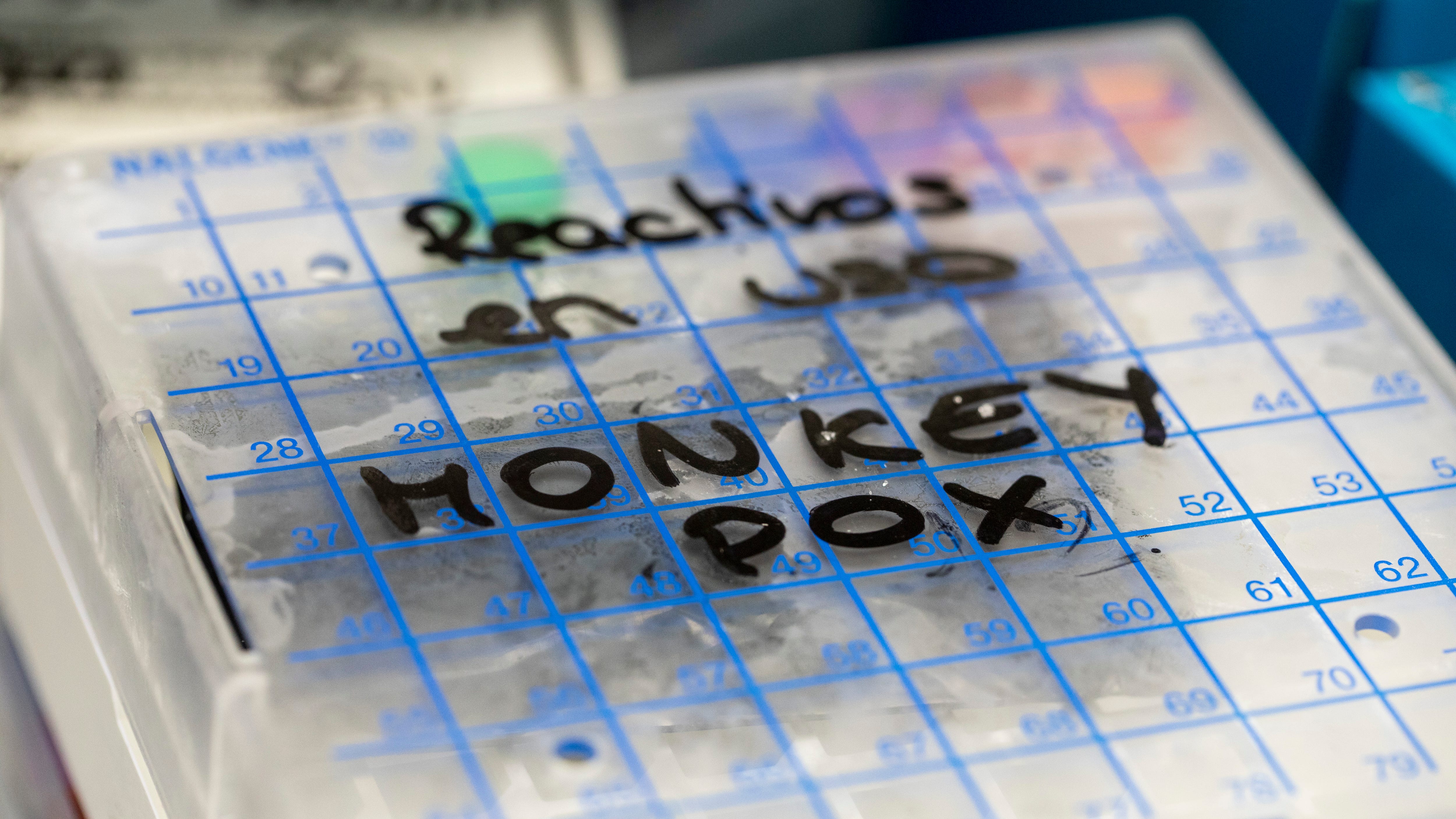 23 monkeypox cases confirmed in NYC