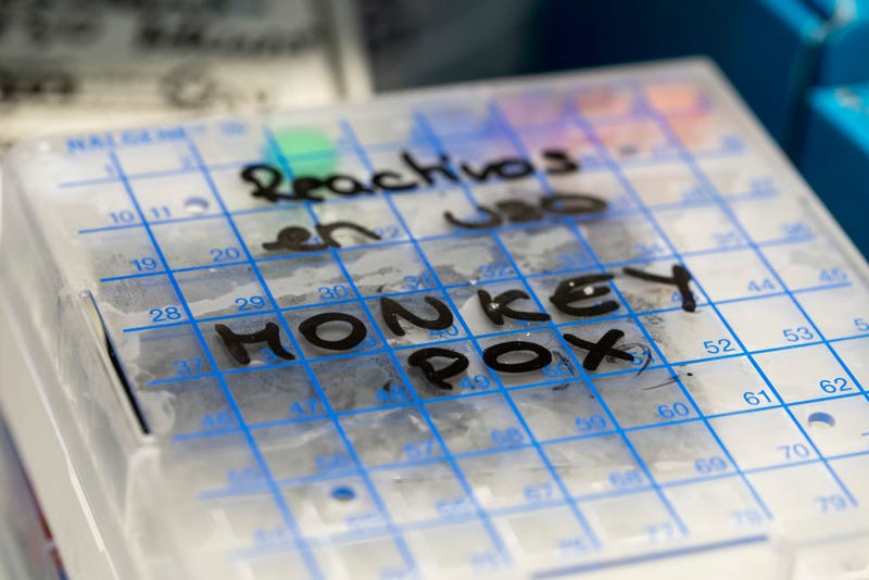A reactive to test suspected monkeypox samples is seen inside a fridge at the microbiology laboratory of La Paz Hospital on June 06, 2022 in Madrid, Spain.
