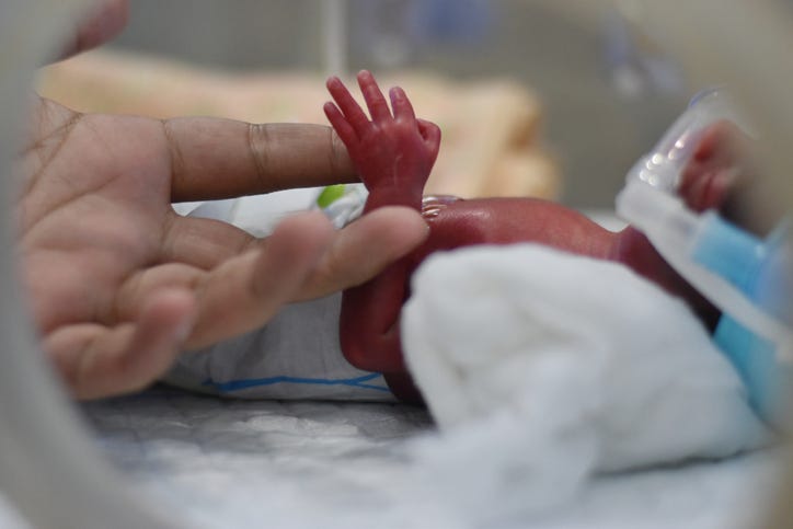 premature baby