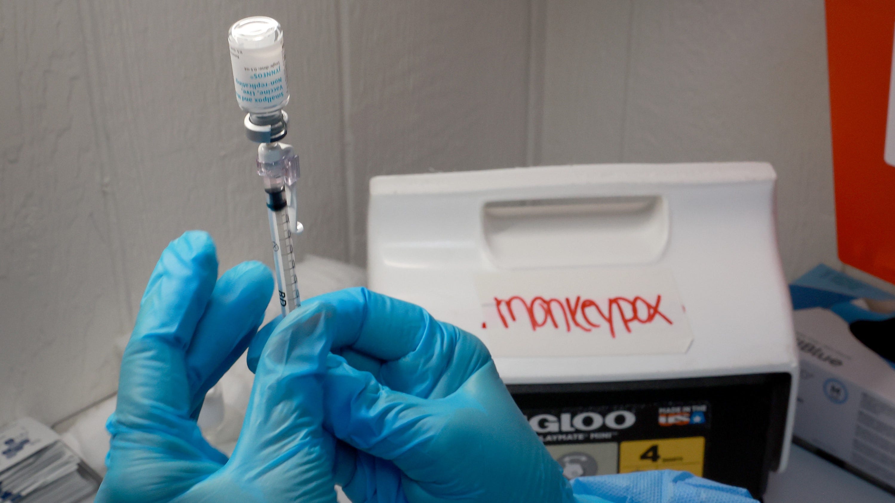 Monkeypox cases drop in US, as public knows more about virus, vaccine