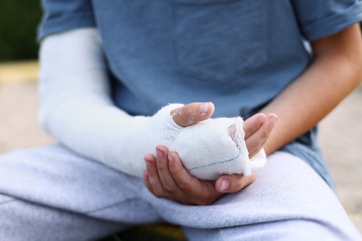 Broken arm