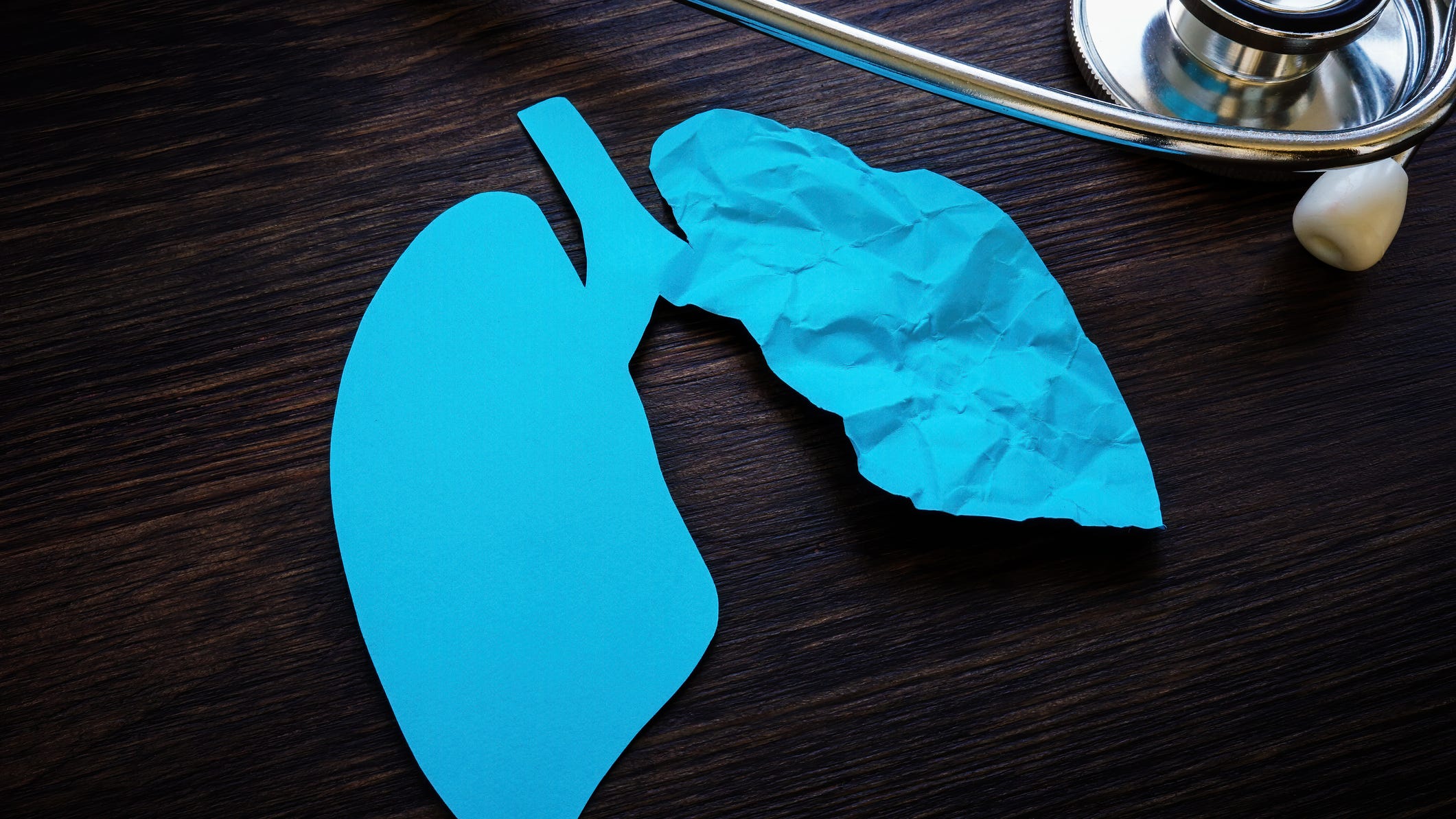 Drug maker accidentally reveals results of promising lung cancer treatment
