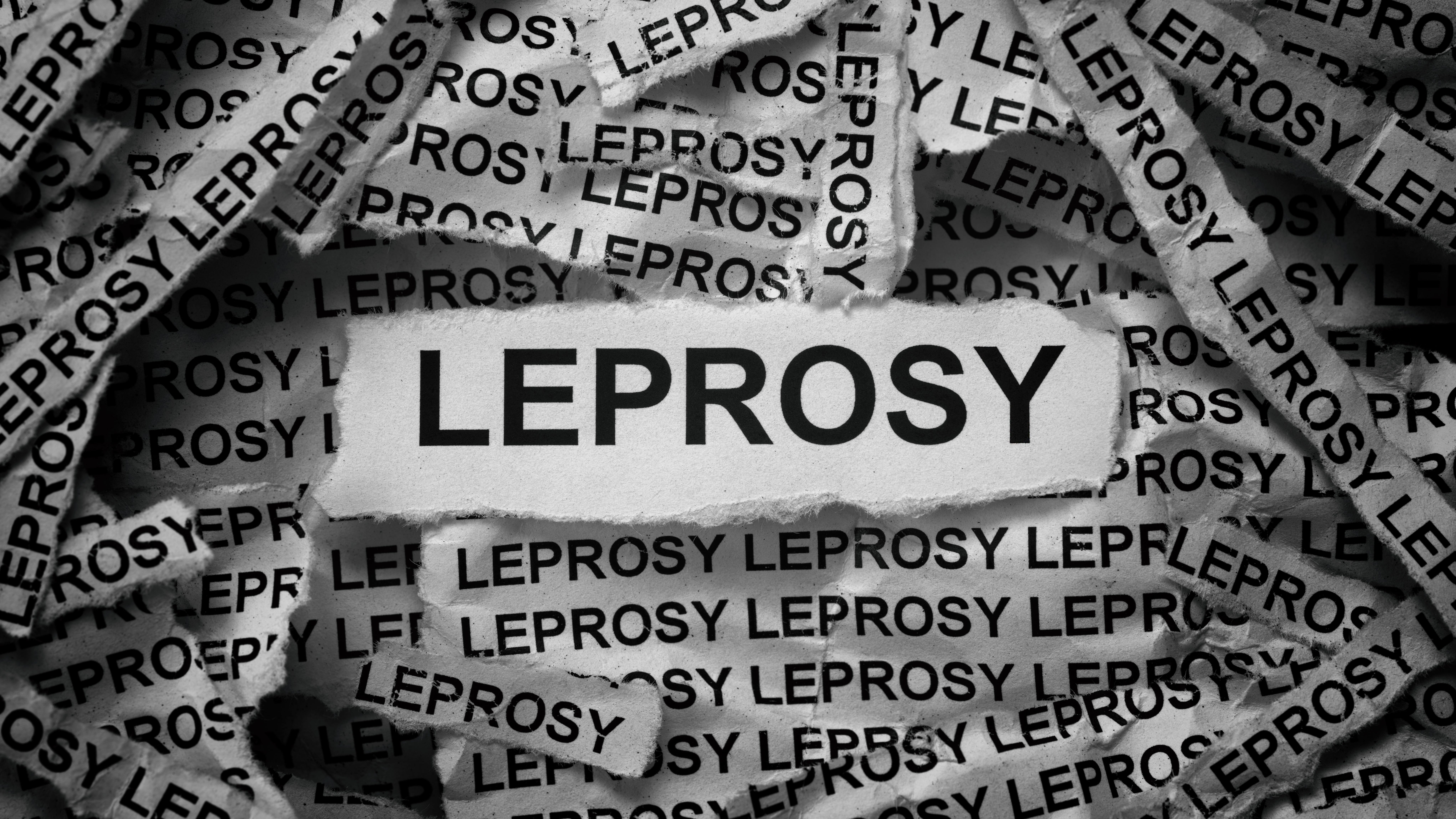 Leprosy cases on the rise in Florida
