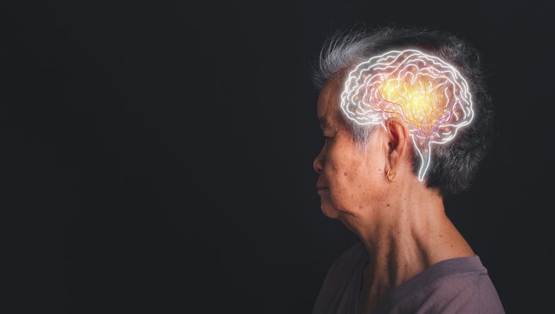 Graphic depicting dementia in an elderly person. 