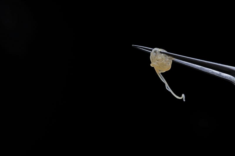 Anisakis. The tip of a surgical forceps holding parasitic fish worms. 