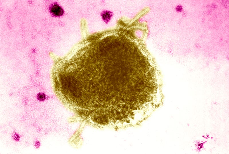 A measles virus is seen under a microscope