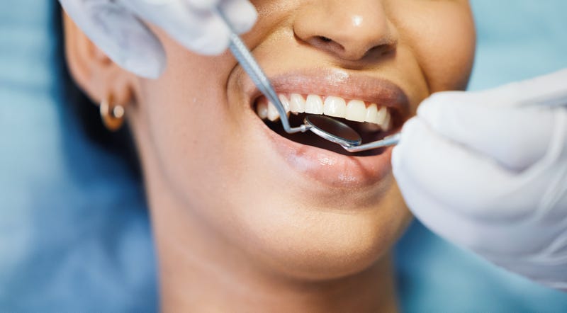 Closeup of dental patient's mouth