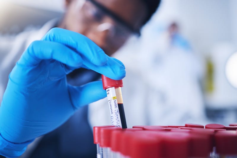 Gloved hand pulling out vial of blood
