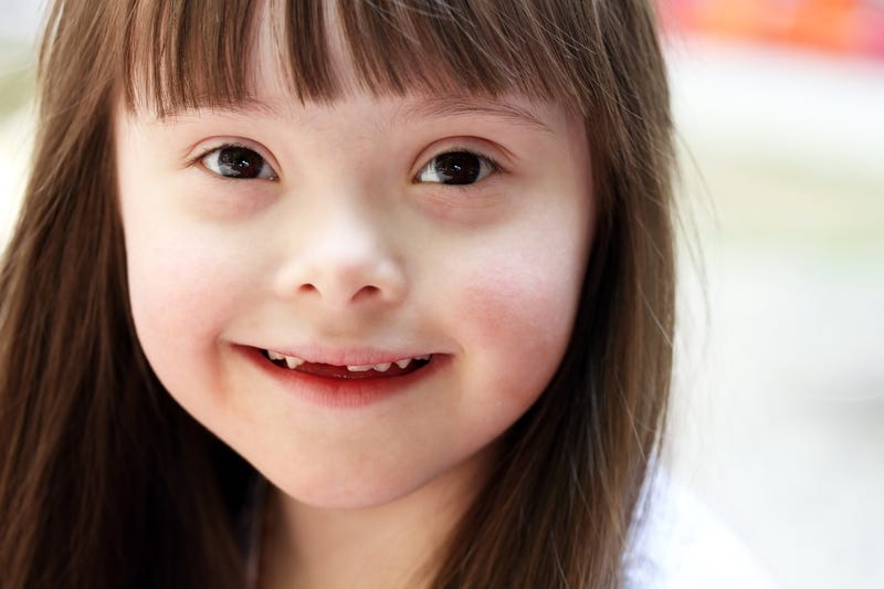 Down syndrome child