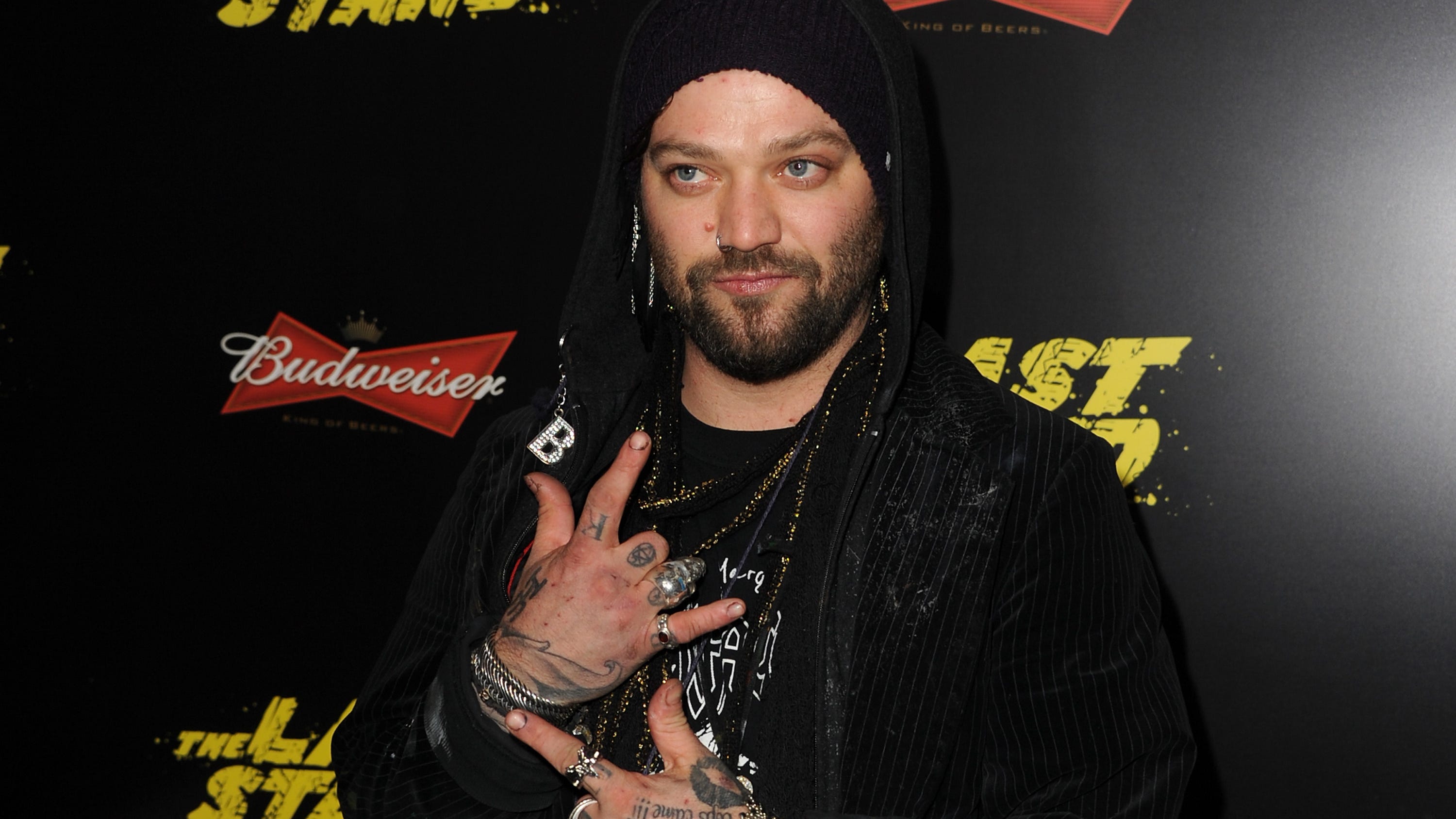 Former 'Jackass' star, Bam Margera, hospitalized and placed on ventilator