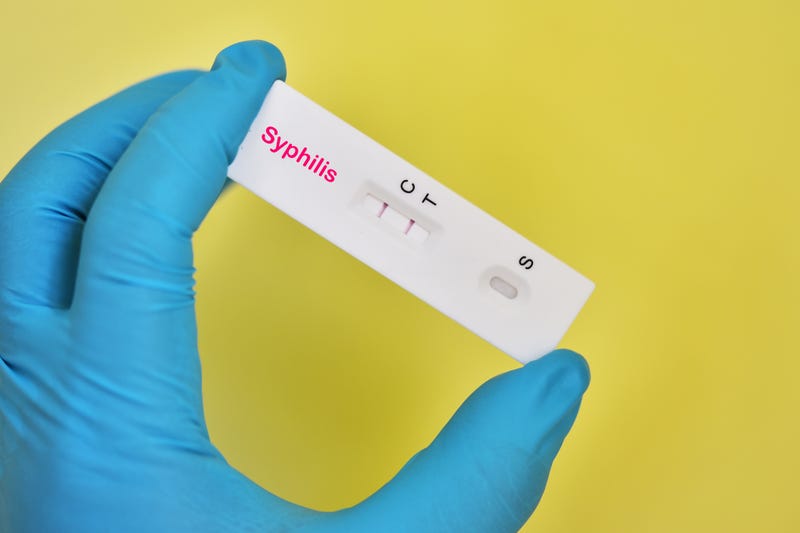 Syphilis cases are skyrocketing