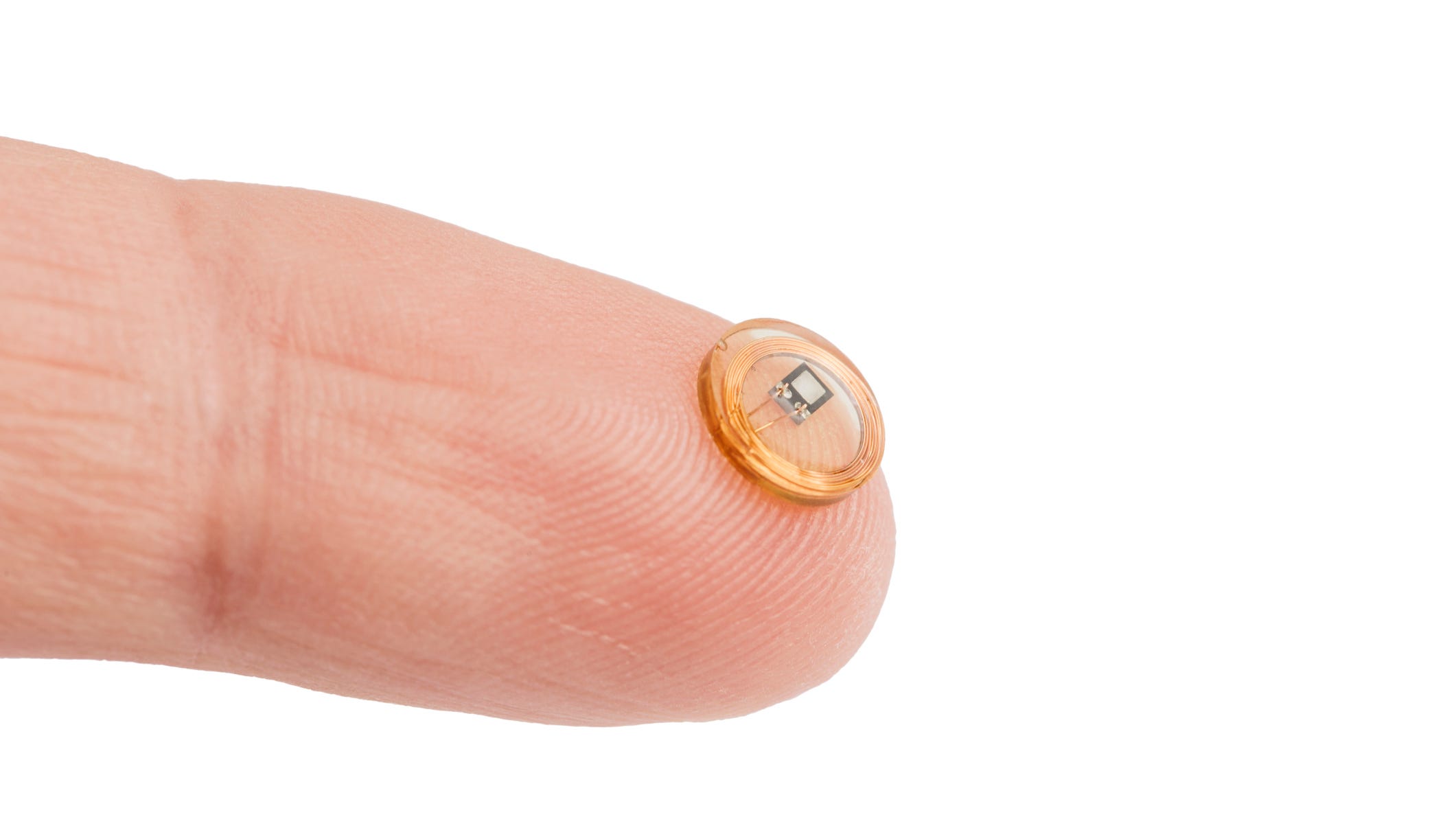 Something Offbeat: Man implants car 'key' in hand