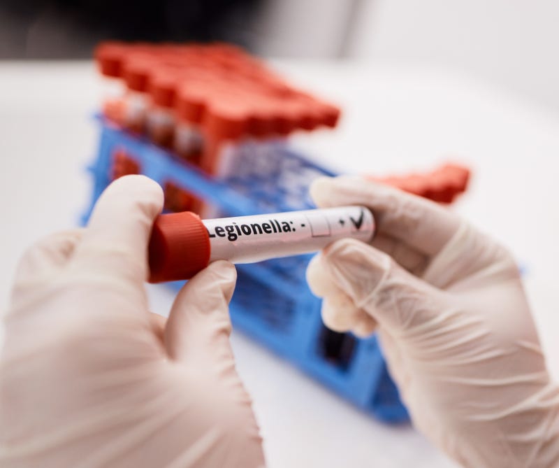 Legionella test