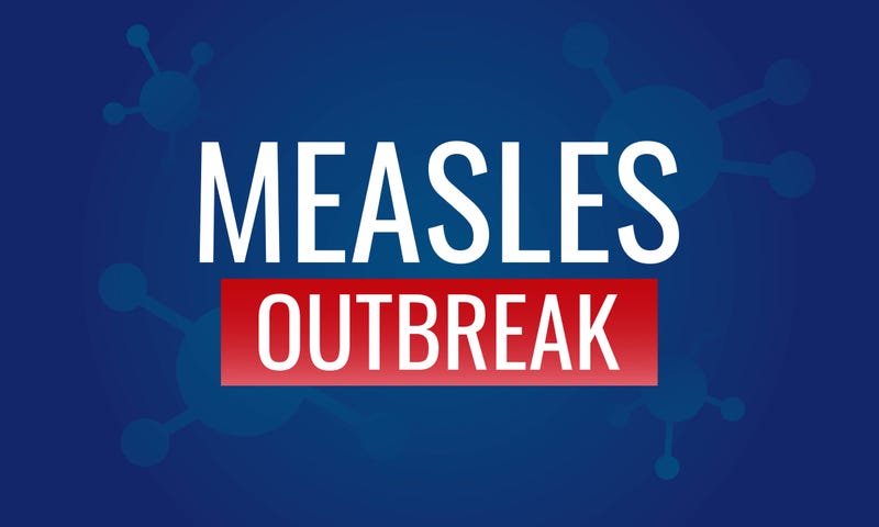 measles