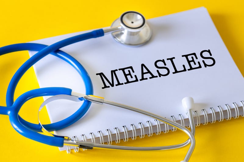 Measles