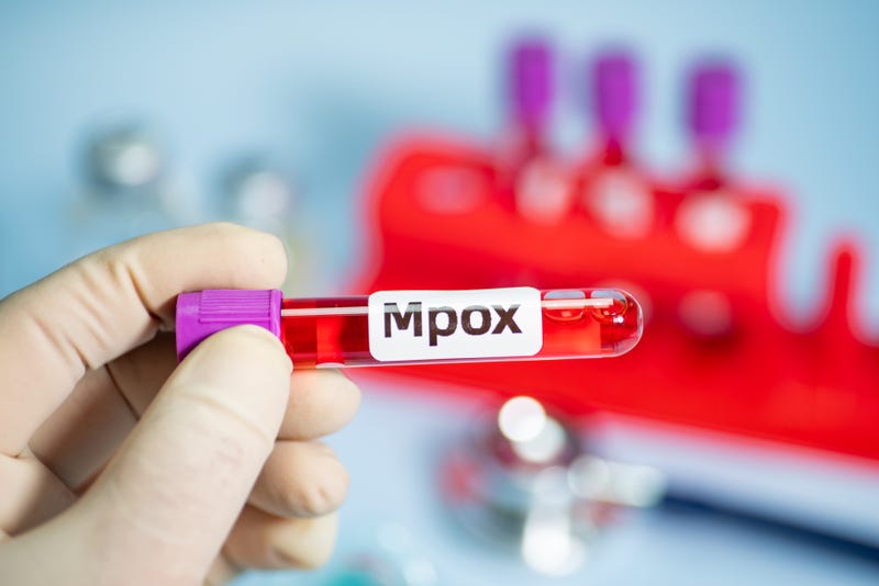 Mpox