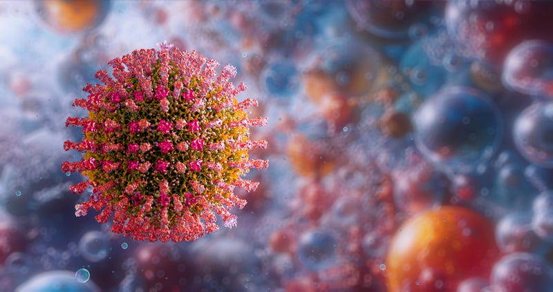 measles