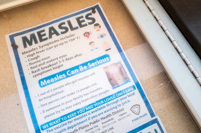 A measles advisory is shown tacked to a bulletin board outside Gaines County Courthouse on April 09, 2025 in Seminole, Texas. A second confirmed measles-related death has been reported in the city of Lubbock amidst an ongoing outbreak which began in late January. As of early April, the Texas Department of State Health Services has confirmed more than 500 cases within 22 counties, ranging from the South Plains toward the Panhandle.
