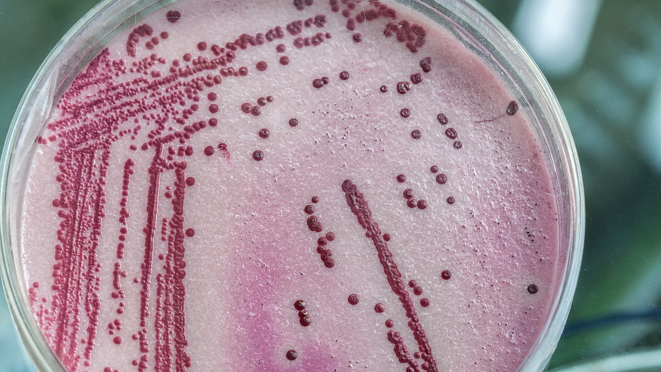 1 dead in Legionnaires' disease outbreak traced to Napa County hotel