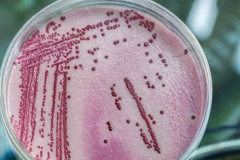Petri dish full of pink and red microbacterias.