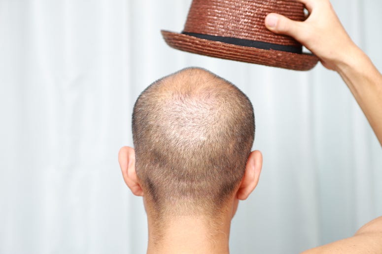 Bald Man, Hat