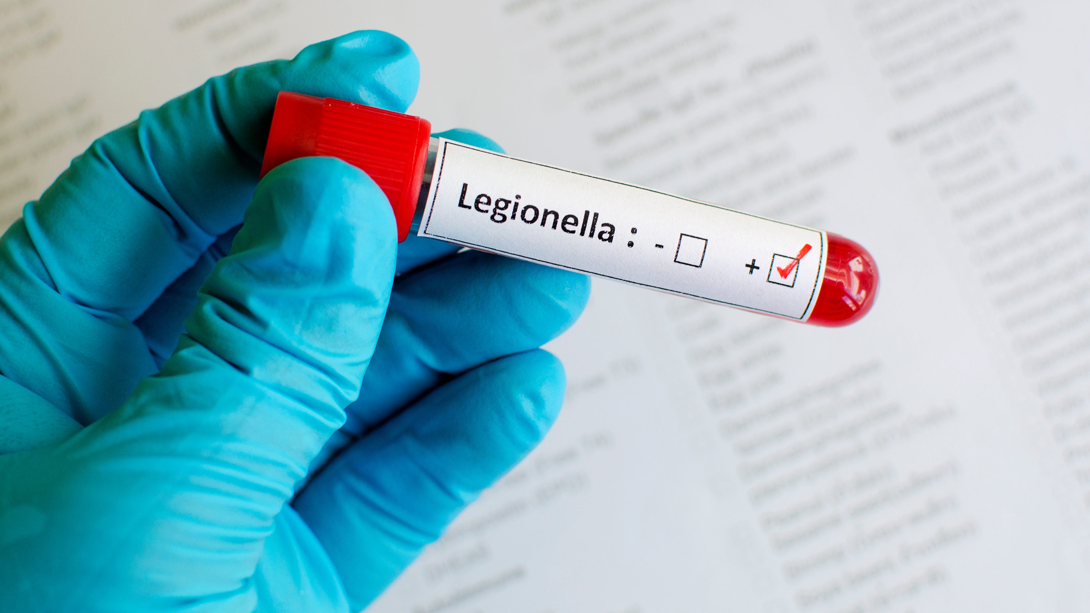 State health department investigating Legionnaires’ disease cluster in Burbank, 4 cases linked to area church