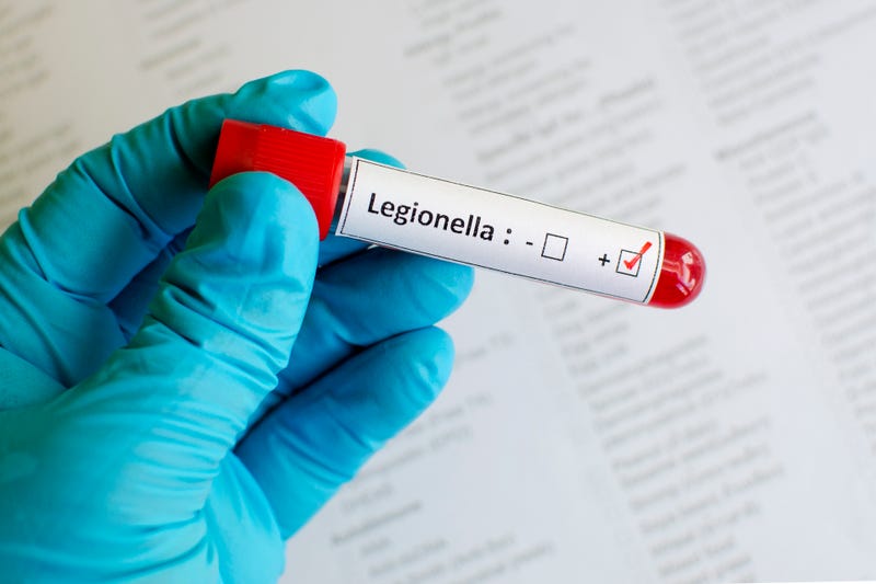 Legionnaire's