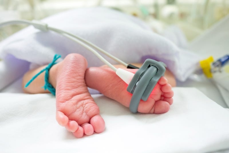 Oxygen monitor on baby's feet