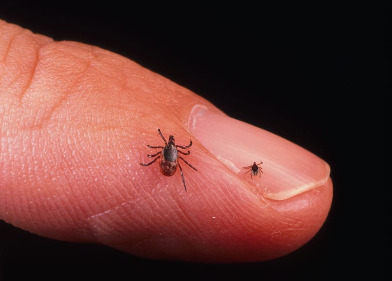 lyme disease