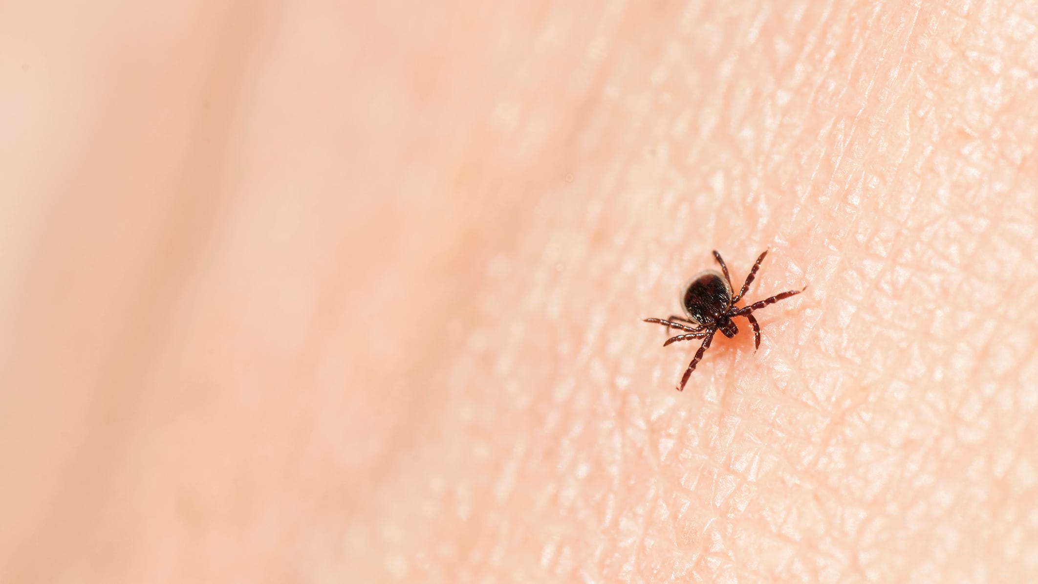 Study: Climate change could make it more likely to get Lyme disease
