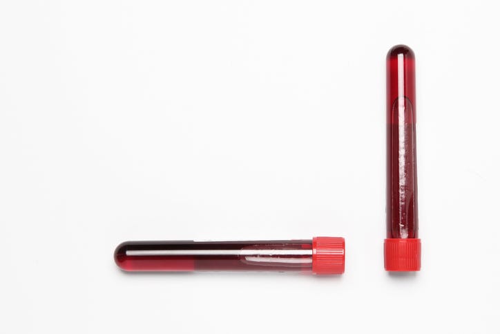 Vials of blood.