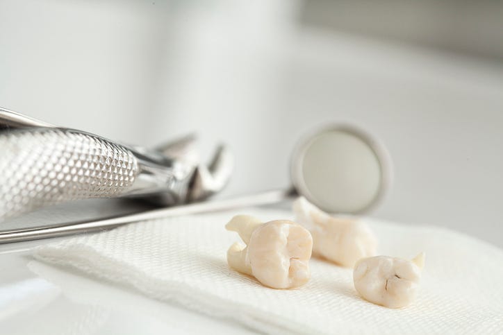 Removed Teeth