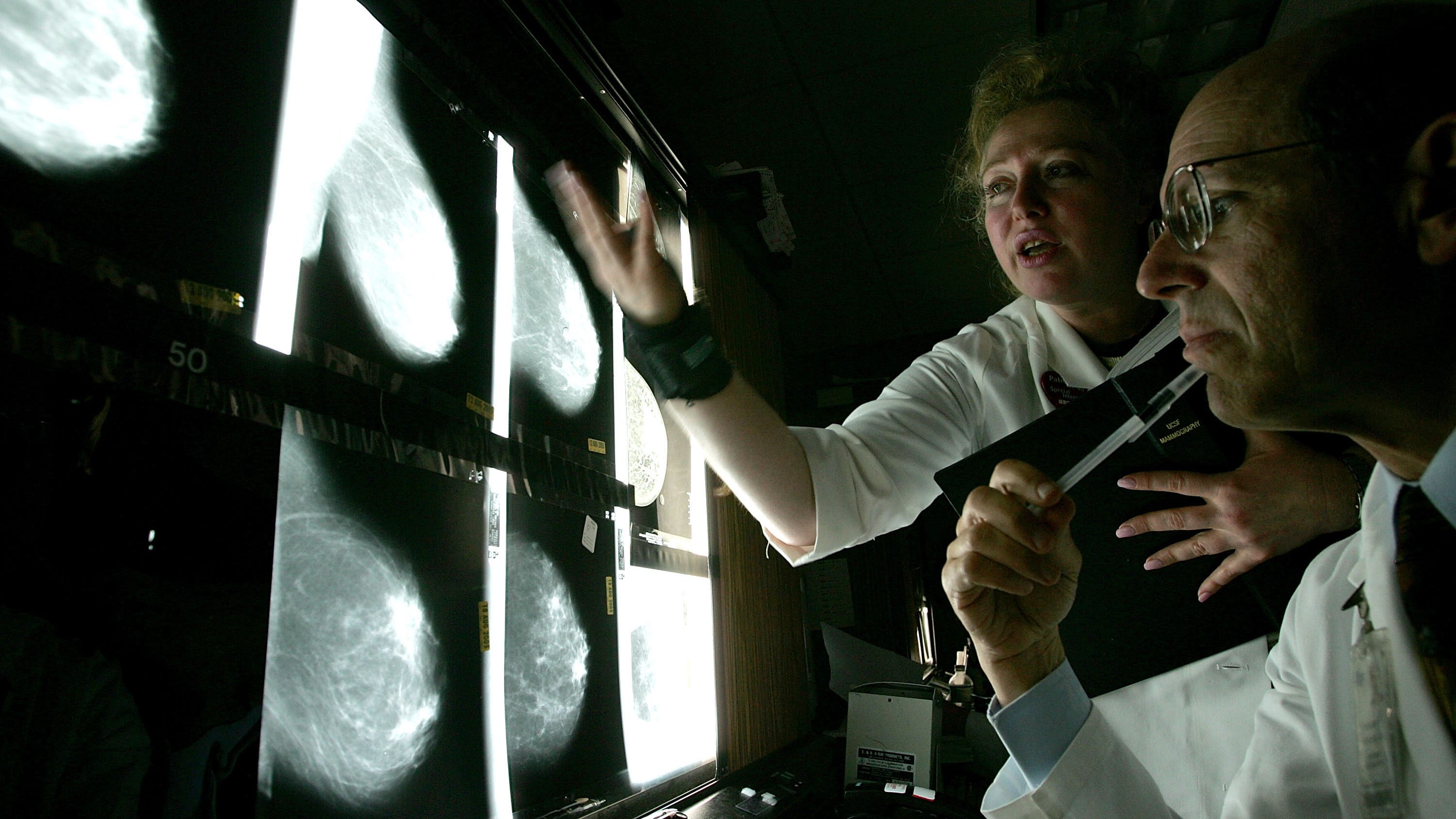 Why an ambitious study wants to change how we screen for breast cancer