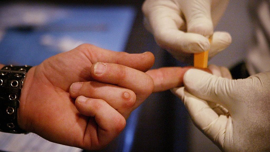 Doctors cure patient of HIV