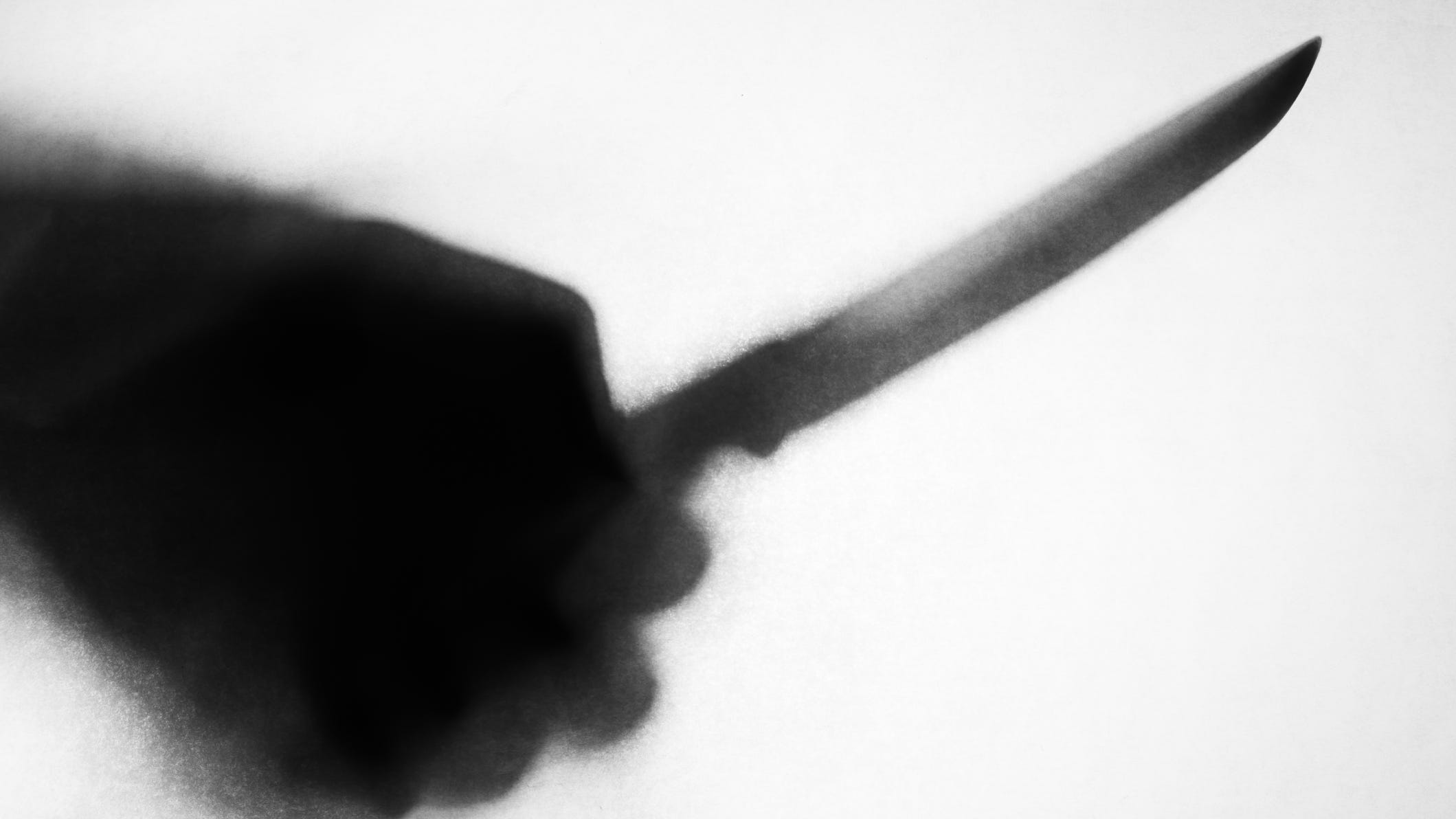 Mother stabs pit bull to death after he mauls her daughter
